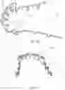 Fig. 25 - Teeth repositioning systems and methods