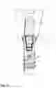 Fig. 08 - Tooth implant