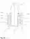 Fig. 11 - Tooth implant