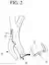Fig. 03 - Forceps for removing dental implant fixture