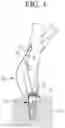 Fig. 05 - Forceps for removing dental implant fixture