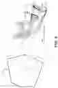 Fig. 06 - Method for virtual setup with mixed dentition