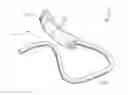 Fig. 01 - DENTAL SUCTION ARRANGEMENT