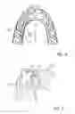 Fig. 04 - DENTAL SUCTION ARRANGEMENT