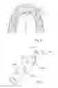Fig. 05 - DENTAL SUCTION ARRANGEMENT