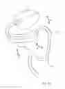 Fig. 10 - DENTAL SUCTION ARRANGEMENT