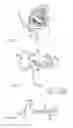 Fig. 11 - DENTAL SUCTION ARRANGEMENT