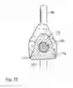 Fig. 12 - DENTAL SUCTION ARRANGEMENT