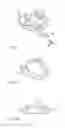 Fig. 13 - DENTAL SUCTION ARRANGEMENT