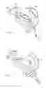 Fig. 15 - DENTAL SUCTION ARRANGEMENT
