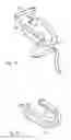 Fig. 16 - DENTAL SUCTION ARRANGEMENT