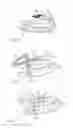 Fig. 17 - DENTAL SUCTION ARRANGEMENT