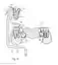 Fig. 21 - DENTAL SUCTION ARRANGEMENT