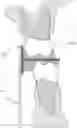 Fig. 01 - Surgical device and methods of use