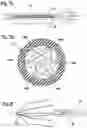 Fig. 10 - Embolus blood clot filter and delivery system