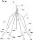 Fig. 11 - Embolus blood clot filter and delivery system