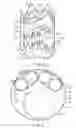 Fig. 06 - Vascular repair devices and methods of use