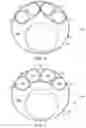 Fig. 07 - Vascular repair devices and methods of use