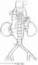 Fig. 19 - Vascular repair devices and methods of use