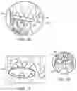 Fig. 22 - Vascular repair devices and methods of use