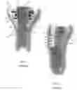 Fig. 02 - Systems and methods for attaching soft tissue to an implant