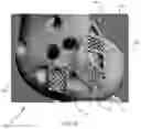 Fig. 04 - Systems and methods for attaching soft tissue to an implant