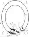 Fig. 02 - Corneal prosthesis and method of penetrating keratoplasty