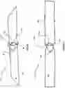 Fig. 04 - Corneal prosthesis and method of penetrating keratoplasty