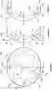 Fig. 05 - Corneal prosthesis and method of penetrating keratoplasty