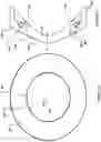 Fig. 08 - Corneal prosthesis and method of penetrating keratoplasty