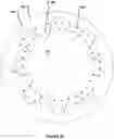 Fig. 12 - Corneal prosthesis and method of penetrating keratoplasty