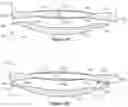 Fig. 05 - Two-part accommodating intraocular lens device