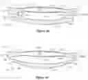 Fig. 06 - Two-part accommodating intraocular lens device