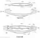 Fig. 10 - Two-part accommodating intraocular lens device