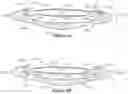 Fig. 11 - Two-part accommodating intraocular lens device
