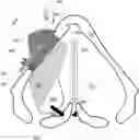 Fig. 01 - METHODS AND APPARATUS FOR TREATING GLOTTIC INSUFFICIENCY