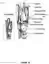 Fig. 03 - METHODS AND APPARATUS FOR TREATING GLOTTIC INSUFFICIENCY