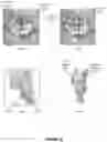Fig. 04 - METHODS AND APPARATUS FOR TREATING GLOTTIC INSUFFICIENCY