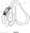 Fig. 08 - METHODS AND APPARATUS FOR TREATING GLOTTIC INSUFFICIENCY