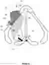 Fig. 10 - METHODS AND APPARATUS FOR TREATING GLOTTIC INSUFFICIENCY