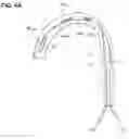 Fig. 05 - Modular percutaneous valve structure and delivery method