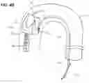Fig. 06 - Modular percutaneous valve structure and delivery method