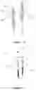 Fig. 04 - Measurement and simulation device used for aortic valve-sparing root replacement operations