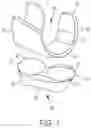 Fig. 02 - Lateral and medial pivoting knee prosthesis