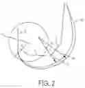 Fig. 03 - Lateral and medial pivoting knee prosthesis