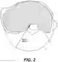 Fig. 03 - TOTAL ANKLE REPLACEMENT WITH ANATOMICALLY FITTED TALAR COMPONENT