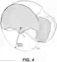 Fig. 05 - TOTAL ANKLE REPLACEMENT WITH ANATOMICALLY FITTED TALAR COMPONENT
