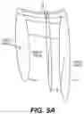 Fig. 06 - TOTAL ANKLE REPLACEMENT WITH ANATOMICALLY FITTED TALAR COMPONENT