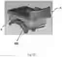 Fig. 19 - TOTAL ANKLE REPLACEMENT WITH ANATOMICALLY FITTED TALAR COMPONENT
