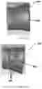 Fig. 23 - TOTAL ANKLE REPLACEMENT WITH ANATOMICALLY FITTED TALAR COMPONENT